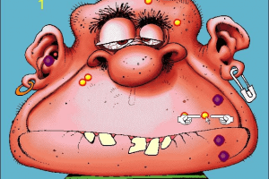 Acne Attack 0