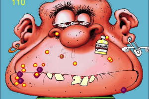 Acne Attack 2