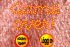 Acne Attack 4
