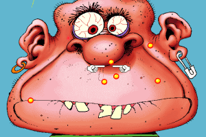 Acne Attack 6