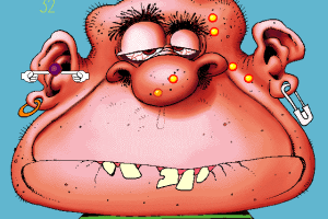 Acne Attack 7