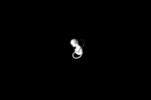 Embryo abandonware
