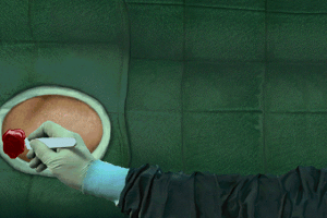Virtual Surgeon: Open Heart 29